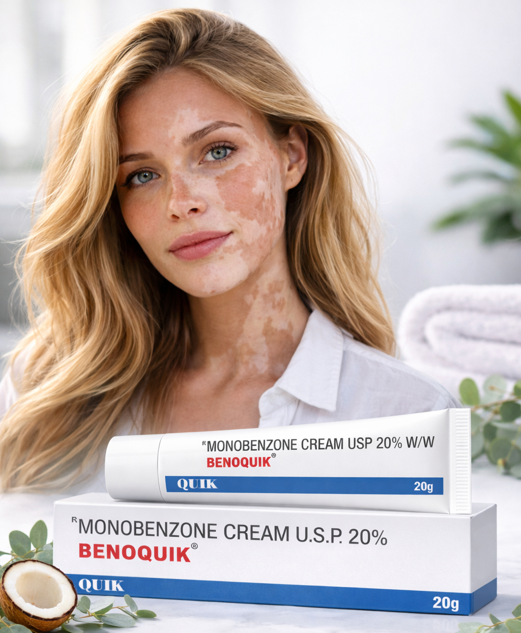 Benoquin 20% Skin Depigmenting Cream – Medical Therapy for Severe Vitiligo